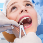 Wisdom teeth, also known as third molars, typically emerge in the late teens or early twenties